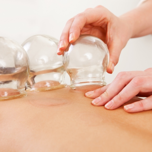 physical-therapy-clinic-cupping-mobility-project-physical-therapy-eugene-or